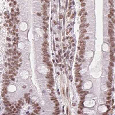 Immunohistochemistry-Paraffin: SFRS12 Antibody [NBP2-57236]