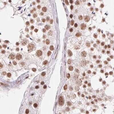Immunohistochemistry-Paraffin: SFRS12 Antibody [NBP2-57236]