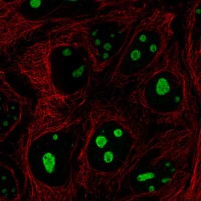 Immunocytochemistry/ Immunofluorescence: SFRS12IP1 Antibody [NBP2-56129]
