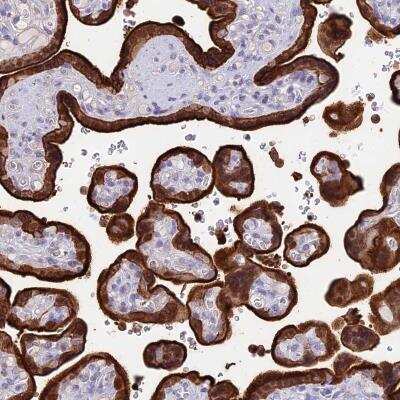 Immunohistochemistry: SFRS12IP1 Antibody [NBP2-47280]