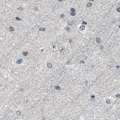 Immunohistochemistry-Paraffin: SFRS15 Antibody [NBP1-88001]
