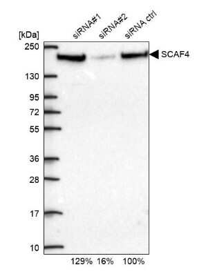 Western Blot: SFRS15 Antibody [NBP1-88002]