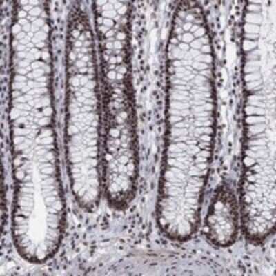 Immunohistochemistry-Paraffin: SFRS18 Antibody [NBP3-17435]