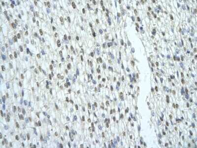 Immunohistochemistry: SFRS2B Antibody [NBP1-57168]