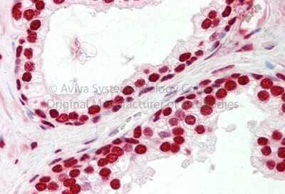 Immunohistochemistry: SFRS2B Antibody [NBP1-57168]