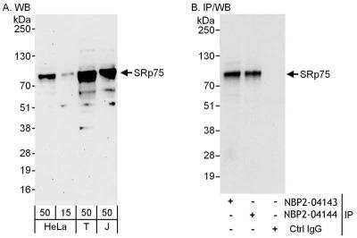 Immunoprecipitation: SFRS4 Antibody [NBP2-04144]