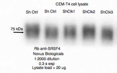 Western Blot: SFRS4 Antibody [NBP2-04144]
