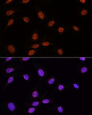 Immunocytochemistry/ Immunofluorescence: SFRS7 Antibody - Azide and BSA Free [NBP2-94049]