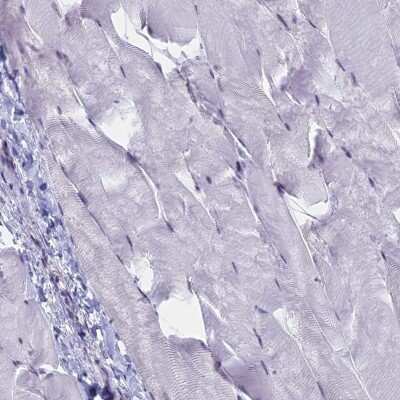 Immunohistochemistry-Paraffin: SFRS7 Antibody [NBP1-92382]