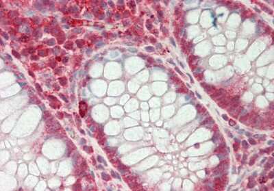 Immunohistochemistry-Paraffin: SFRS7 Antibody [NBP2-88251]