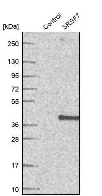 Western Blot: SFRS7 Antibody [NBP2-49238]