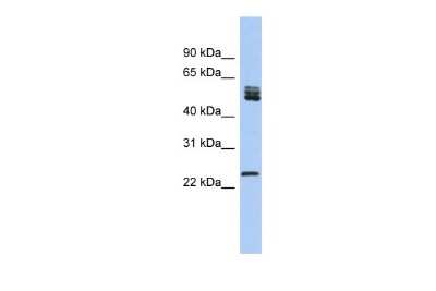 Western Blot: SFRS7 Antibody [NBP2-88251]