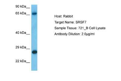 Western Blot: SFRS7 Antibody [NBP2-88254]