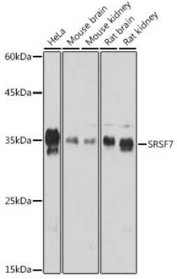 Western Blot: SFRS7 AntibodyAzide and BSA Free [NBP2-94049]