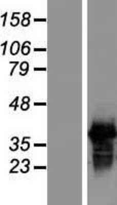 Western Blot: SFRS7 Overexpression Lysate [NBL1-15892]