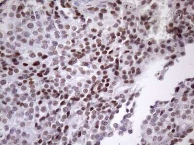 Immunohistochemistry: SFRS9 Antibody (OTI5G7) [NBP2-45429]