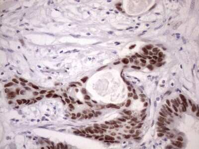 Immunohistochemistry: SFRS9 Antibody (OTI5G7) [NBP2-45429]