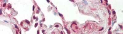 Immunohistochemistry: SFRS9 Antibody [NBP1-57465]