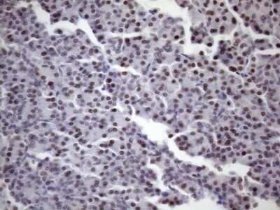 Immunohistochemistry: SFRS9 Antibody (OTI5G7) - Azide and BSA Free [NBP2-74152]