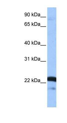 Western Blot: SFRS9 Antibody [NBP1-57465]
