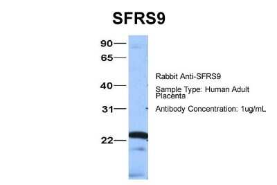 Western Blot: SFRS9 Antibody [NBP1-57465]