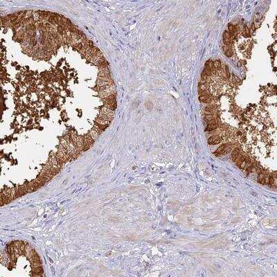 Immunohistochemistry: SFT2B Antibody [NBP1-88013]