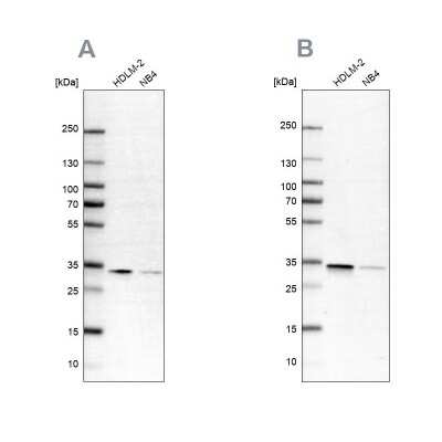 Western Blot: SFXN1 Antibody [NBP1-83708]