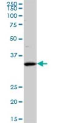 Western Blot: SFXN3 Antibody (4A3) [H00081855-M01]