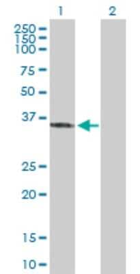 Western Blot: SFXN3 Antibody [H00081855-D01P]
