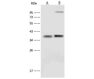 Western Blot: SFXN5 Antibody [NBP2-99580]