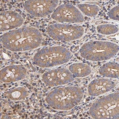 Immunohistochemistry-Paraffin: SG2NA Antibody [NBP1-80764]