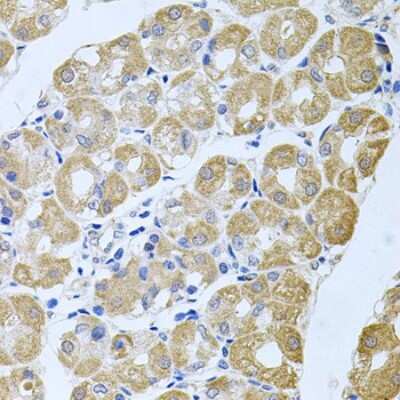Immunohistochemistry-Paraffin: SG2NA Antibody - BSA Free [NBP2-94911]
