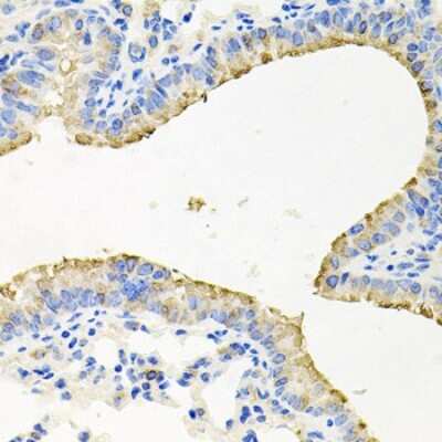 Immunohistochemistry-Paraffin: SG2NA Antibody - BSA Free [NBP2-94911]