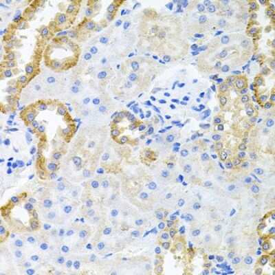 Immunohistochemistry-Paraffin: SG2NA Antibody - BSA Free [NBP2-94911]