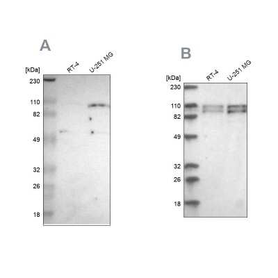 Western Blot: SG2NA Antibody [NBP1-80763]