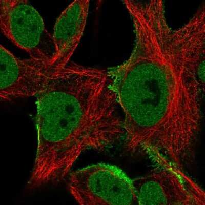 Immunocytochemistry/ Immunofluorescence: epsilon-Sarcoglycan Antibody [NBP2-57804]
