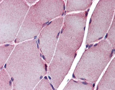 Immunohistochemistry: epsilon-Sarcoglycan Antibody [NBP1-59794]