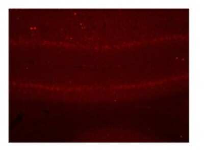 Immunohistochemistry-Paraffin: epsilon-Sarcoglycan Antibody [NBP1-59794]