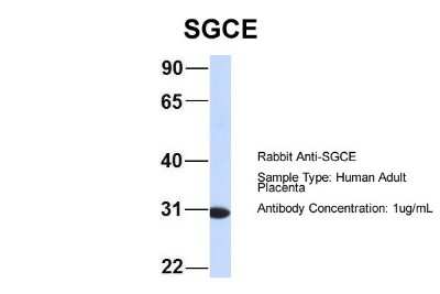 Western Blot: epsilon-Sarcoglycan Antibody [NBP1-59794]