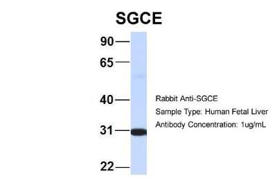 Western Blot: epsilon-Sarcoglycan Antibody [NBP1-59794]