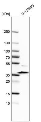Western Blot: epsilon-Sarcoglycan Antibody [NBP2-57804]