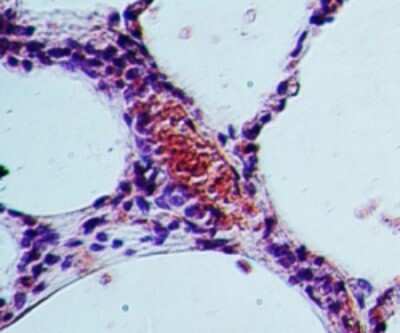 Immunohistochemistry-Paraffin: SGK1 Antibody [NBP2-19010]