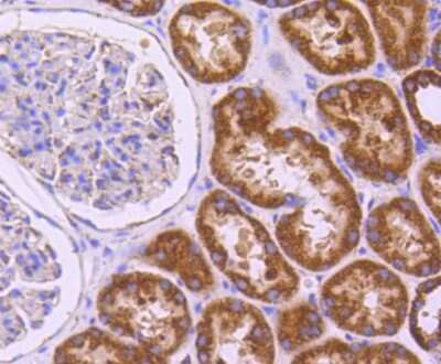 Immunohistochemistry-Paraffin: SGK1 Antibody (SC05-71) [NBP2-67561]