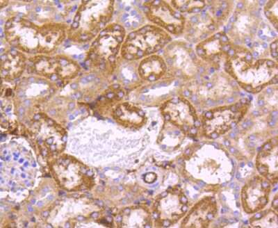 Immunohistochemistry-Paraffin: SGK1 Antibody (SC05-71) [NBP2-67561]