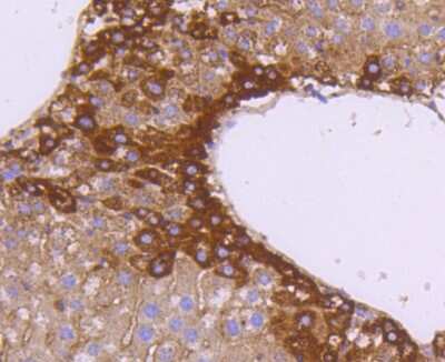 Immunohistochemistry-Paraffin: SGK1 Antibody (SC05-71) [NBP2-67561]