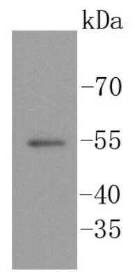 Western Blot: SGK1 Antibody (SC05-71) [NBP2-67561]