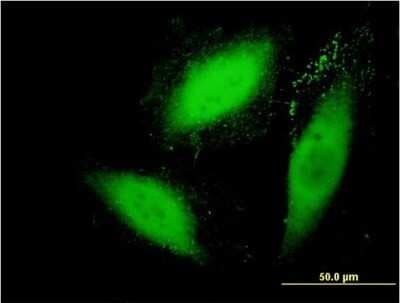 Immunocytochemistry/ Immunofluorescence: SGK2 Antibody (3D2) [H00010110-M09]