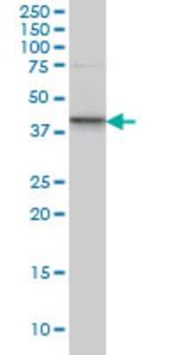 Western Blot: SGK2 Antibody (3D2) [H00010110-M09]