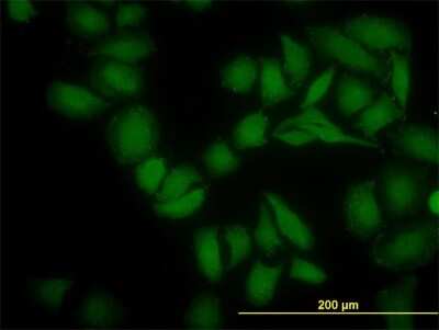 Immunocytochemistry/ Immunofluorescence: SGK2 Antibody (4G4) [H00010110-M05]