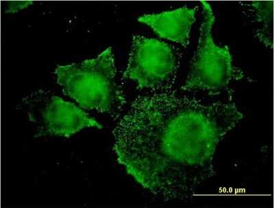 Immunocytochemistry/ Immunofluorescence: SGK2 Antibody (7C7) [H00010110-M08]
